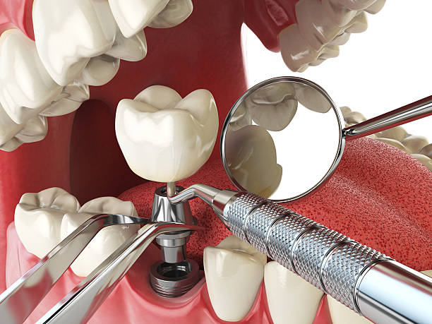 Best Emergency Denture Repair in Richwood, NJ