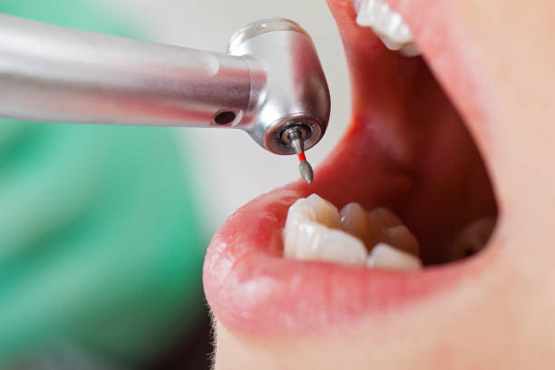 Best Emergency Tooth Extraction in Richwood, NJ